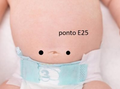 Como Melhorar Cólicas de Bebês de Forma Natural 1 colicabebepontoE25