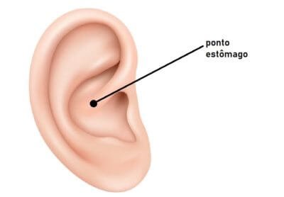 Como Melhorar Cólicas de Bebês de Forma Natural 3 pontoestomago 1