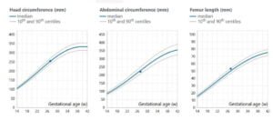 Quantos Ultrassom se faz na Gravidez? 2 Quantos Ultrassom se faz na Gravidez