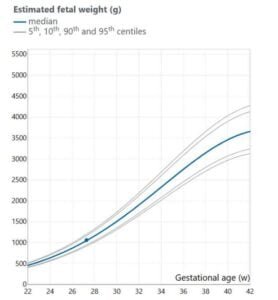 Quantos Ultrassom se faz na Gravidez? 3 peso fetal